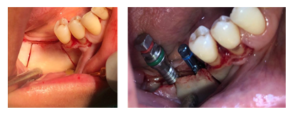 12.png
