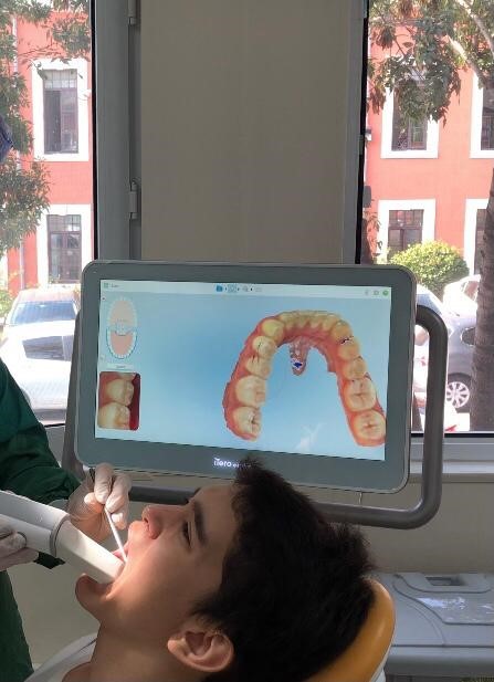 Ortodontide Şeffaf Plak Tedavileri-1.jpg